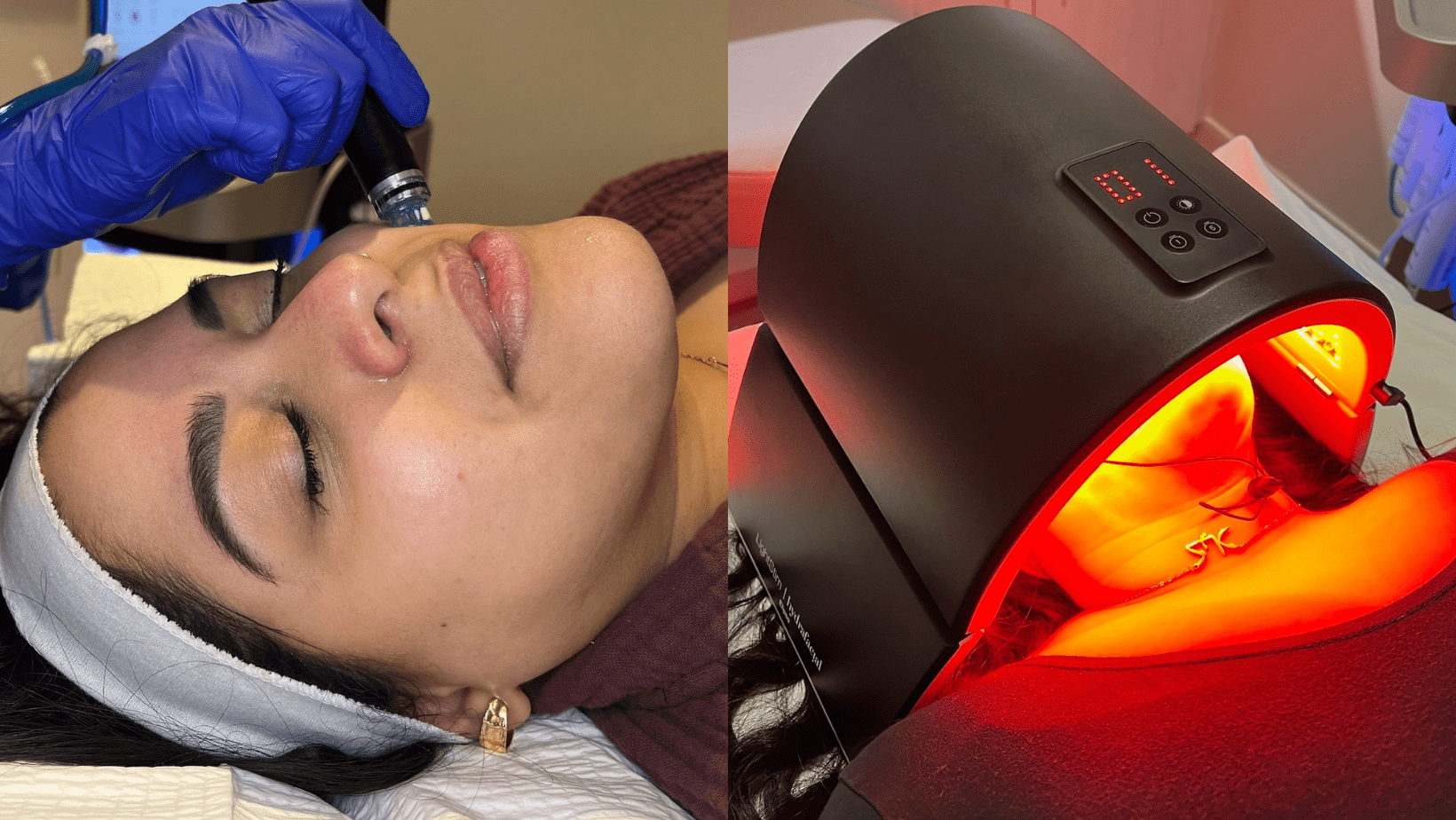 Deluxe HydraFacial